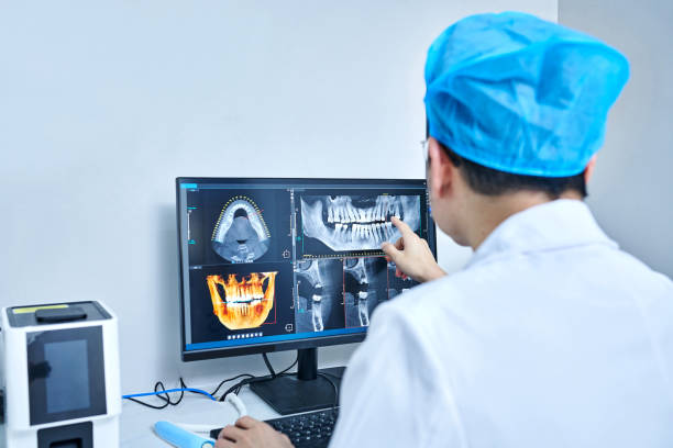 Best Emergency Wisdom Tooth Extraction in Mayfair, CA